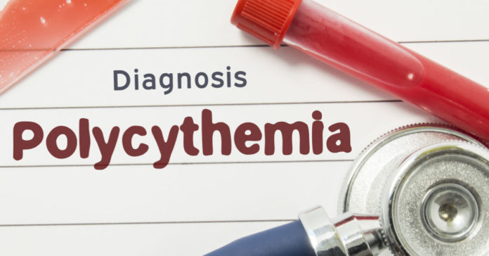 the-causes,-symptoms,-and-treatments-of-polycythemia-vera