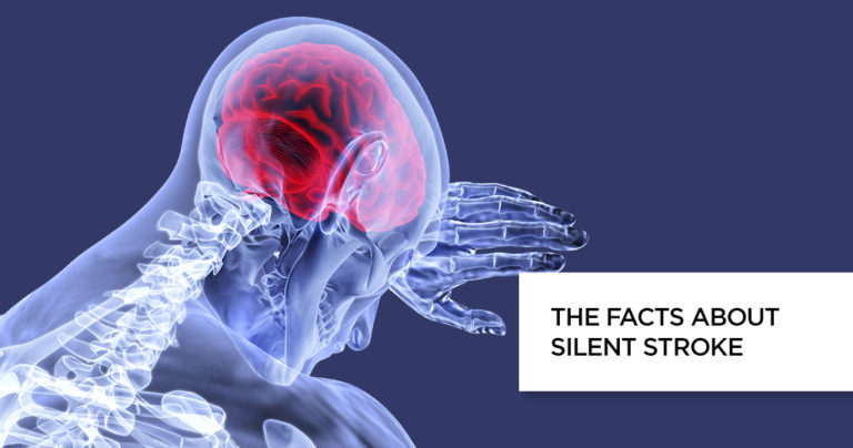 information-on-silent-stroke