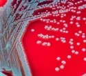A study discovered that some bacteria cells get hungry as well